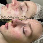 FlaxTap (ulitsa Voronova, 8), cosmetology