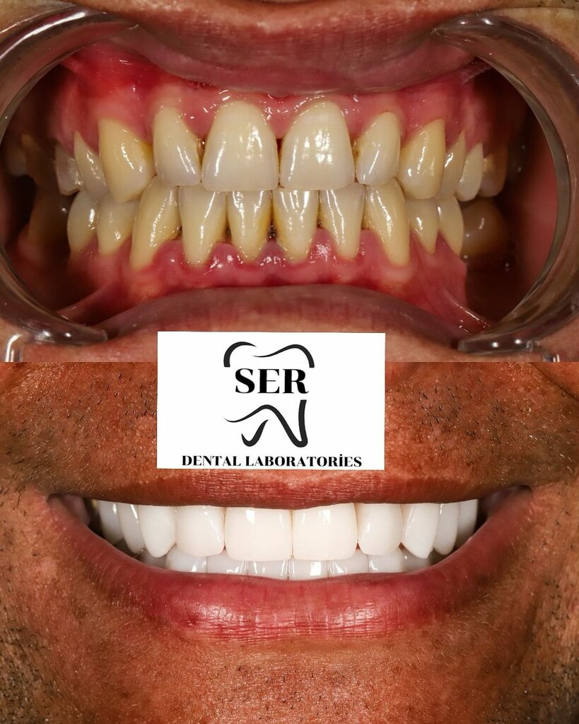 Dental laboratory Ser Dental Prosthesis Laboratory, Antalya, photo