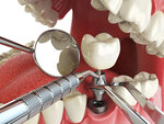 Dr_Aziz_dental_clinic (Tayyr Zharokov Street, 137/1блокГ3), dental clinic