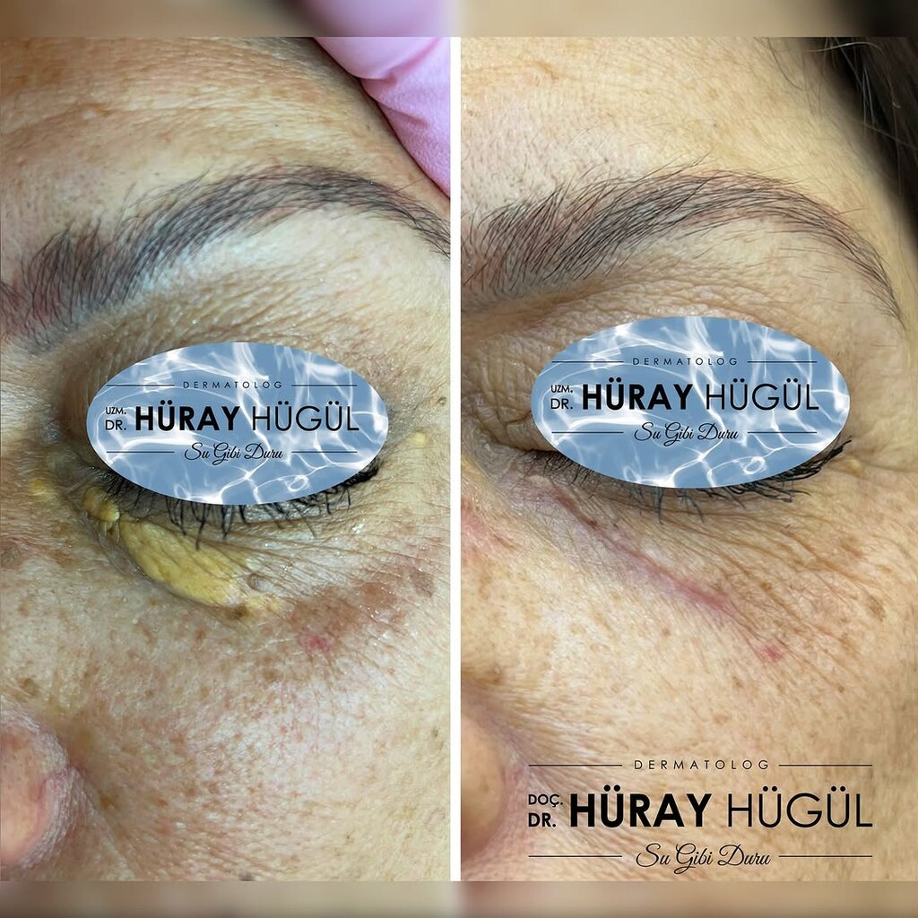 Beauty salon Dermatologist Dr. Huray Hugul, Antalya, photo