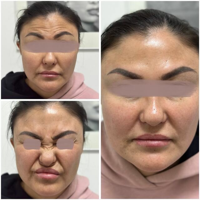 Plastic surgery Lovely queen, Almaty, photo