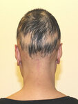 Bodrum Hair Prosthesis (Mugla, Bodrum, Konacık Mah., Cumhuriyet Cad., 184A), plastic surgery