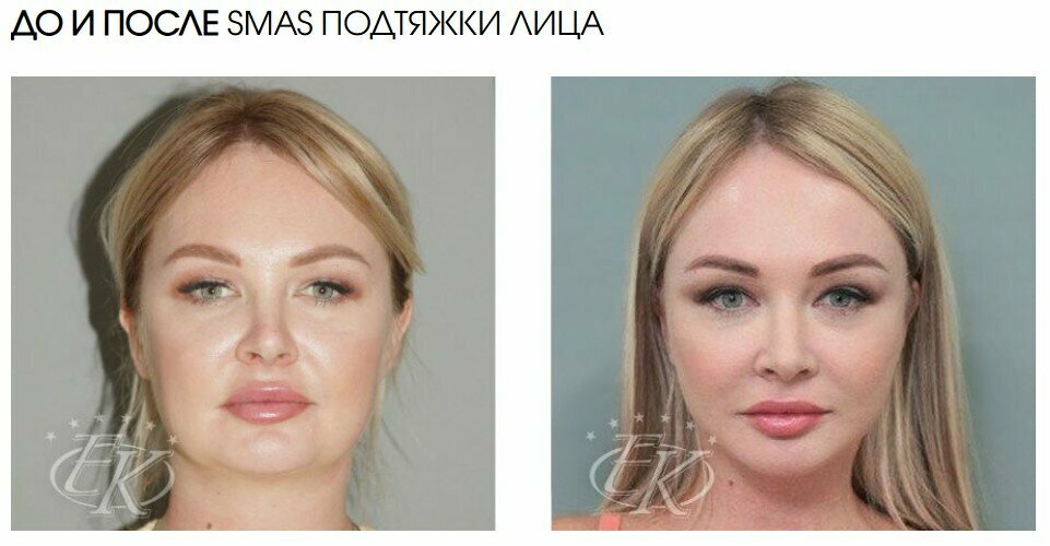 جراحة تجميلية Plasticheskaya khirurgiya doktora Kudinovoy ، موسكو، صورة
