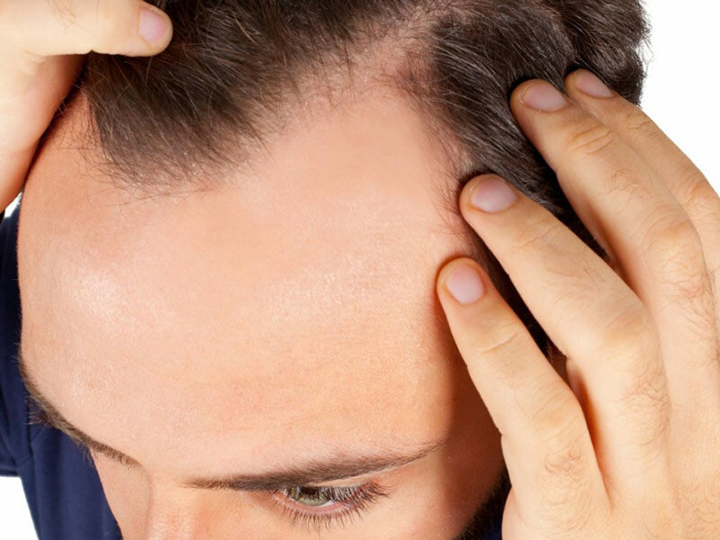 Estetik Hair Antalya Saç Ekimi