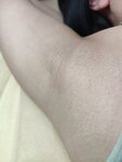 Pill Epil (ulitsa Preobrazhenskogo, 20) ، إزالة الشعر