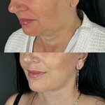 Пластический хирург Асланян Г. М. (Vardanants Street No:110, Yerevan), özel muayenehaneler  Erivan'dan