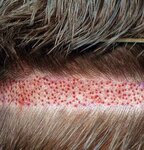 Nigde Hair Transplant Center (Konya, Meram District, Askan Neighborhood, Mursel Street, 14), medical center, clinic