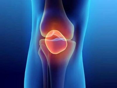 Private practice doctors Prof. Dr. Murat Bozkurt - Joint Surgery Arthroscopy Arthroplasty Cartilage - Stem Cell Therapy, Ankara, photo