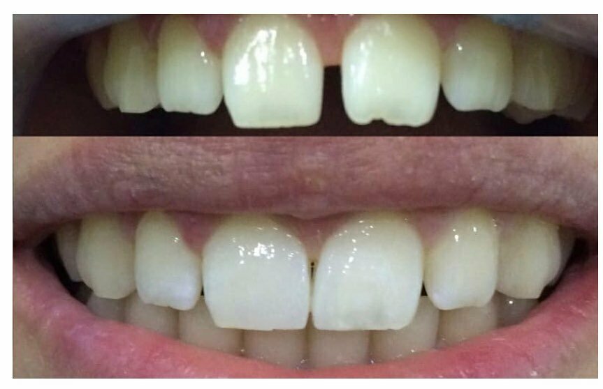 عيادات الأسنان Platin Dental Clinic ، آدابازاري، صورة