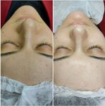 Beauty For Girls (Sovremennaya ulitsa, 11), cosmetología