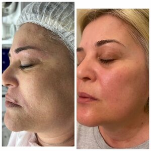 Serra Beauty Salon (Konya, Cumra District, Bardakci Neighborhood, 72127th Street, 2), beauty salon