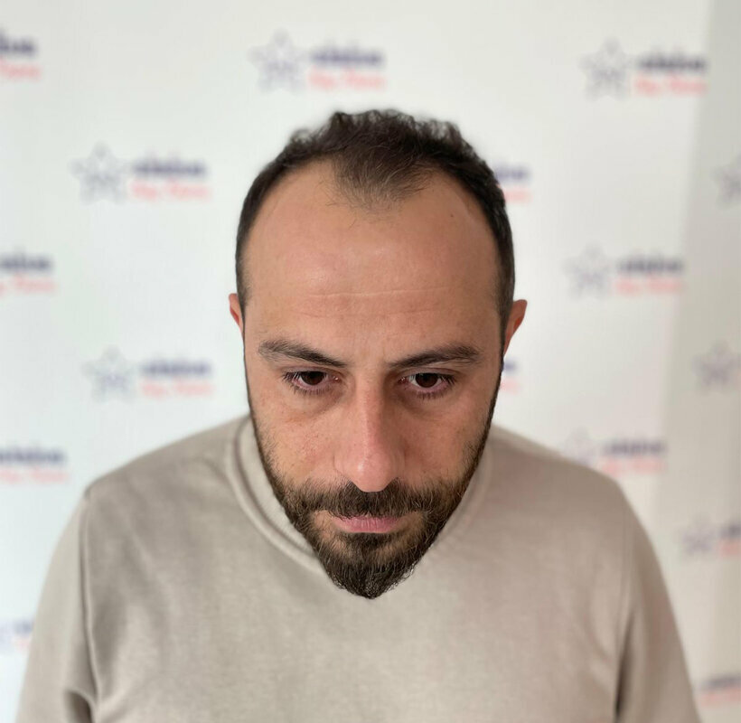 Medical center, clinic Samsun Sirius Hair Transplant Center, Samsun, photo