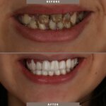 Can Metiner Prosthesis Specialist (Istanbul, Rami Kisla Avenue, 40-44G), dental clinic