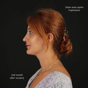 Vital Estetik (Antalya, Muratpaşa, Kızılsaray Mah., Yener Ulusoy Blv., 24) ، صالون تجميل