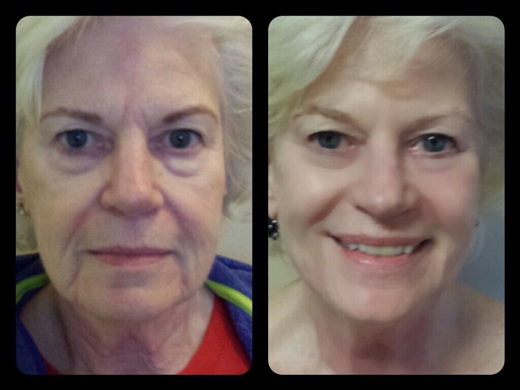 Spa Cosmetic Laser and Beauty SPA, Louisville, photo