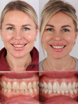 Sanitas Turkey (İstanbul, Şişli, 19 Mayıs Mah., 19 Mayıs Cad., 1), dental clinic