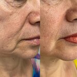 Shans (Marshala Zhukova Street, 8), cosmetology