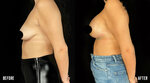 Op. Dr. Ayla Gokce (Istanbul, Sisli, Rumeli Avenue, 6), private practice doctors