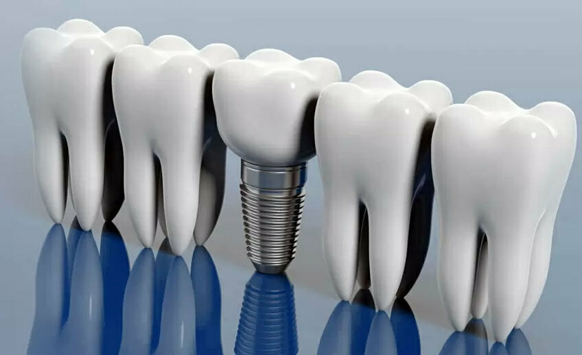 Dental clinic Denti Delil Oral and Dental Health Clinic, Istanbul, photo