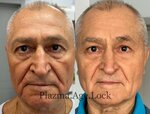 Plazma Age Lock (Bolshye Kamenschiki Street, 3с2), cosmetology