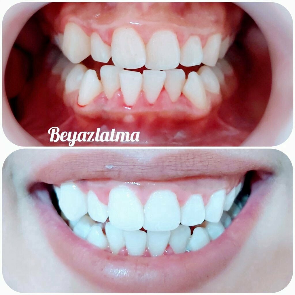 Private practice doctors Dentist Aysegul Inneci Uzun-Implantology and Aesthetic Dental Clinic Kayseri, Kayseri, photo