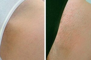 Лесби қынапты жалайды