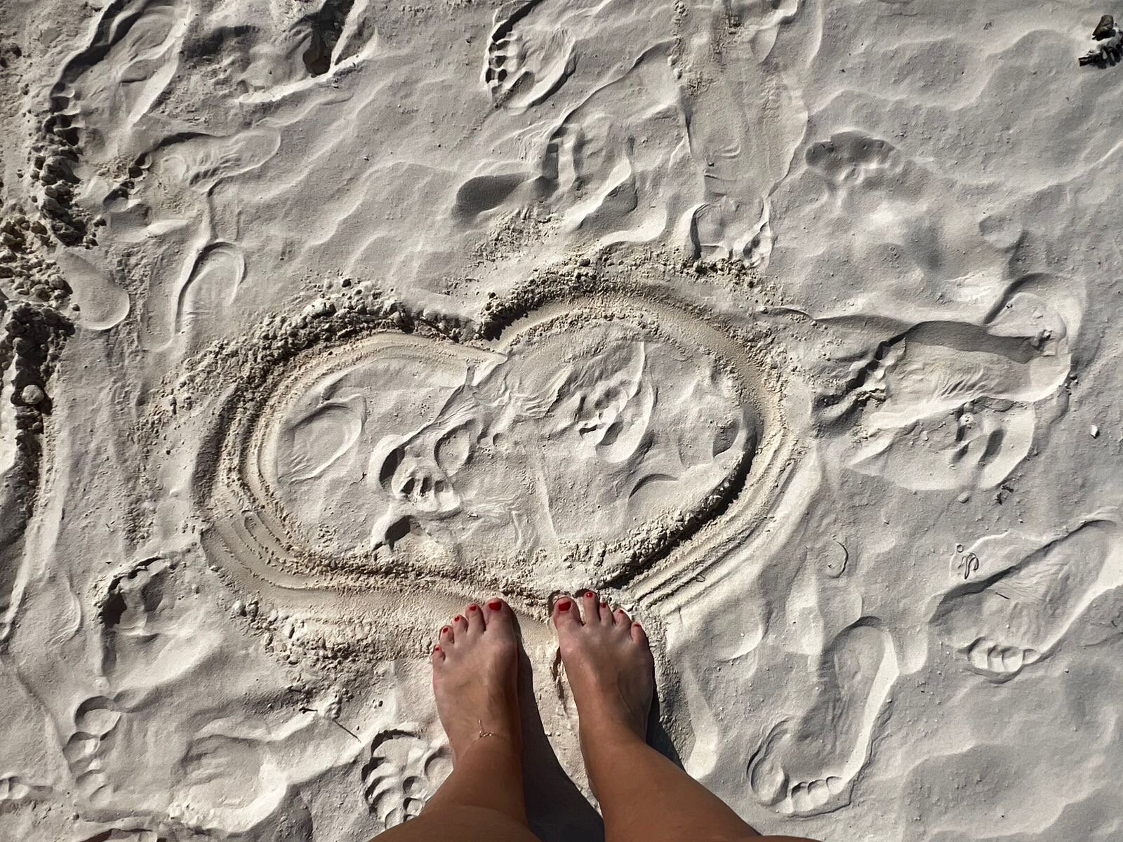 Фото Tropicana Kendwa Beach