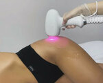 Pro: Тебя (Rabochaya ulitsa, 100), hair removal