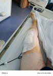 Inozemtsev Clinical Hospital, Traumatology Department (Fortunatovskaya Street, 1к10) ، قسم المستشفى