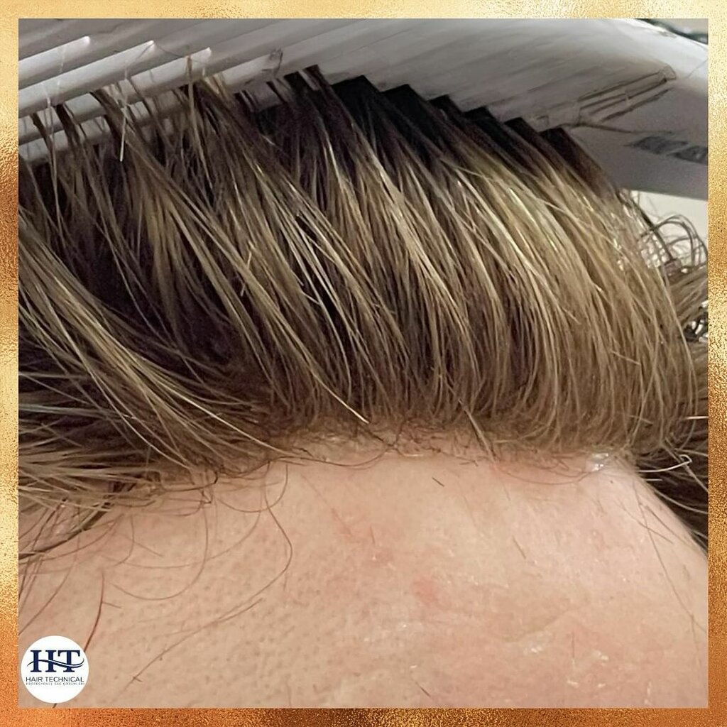 Manufacture of prosthetic and orthopedic products Prosthetic Hair Hair Technical, Istanbul, photo