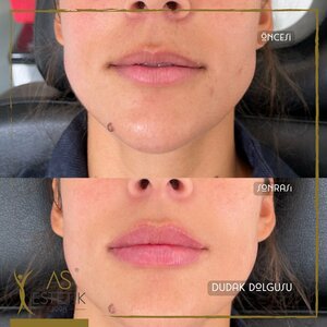 AS Estetik (İstanbul, Kartal, Üsküdar Cad., 44), salón de belleza