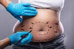 Black Pearl Clinic (İstanbul, Bakirkoy District, Çobançeşme E-5 Yan Yol Cad., 20), plastic surgery