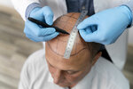 Hair Transplant Istanbul, Turkey, Men/Women Hair Restoration Turkey, Dhi/Sapphire Fue Hair Transplant Turkey (İstanbul, Şişli, Mecidiyeköy Mah., Selahattin Pınar Cad., 1B), servicios de especialistas privados
