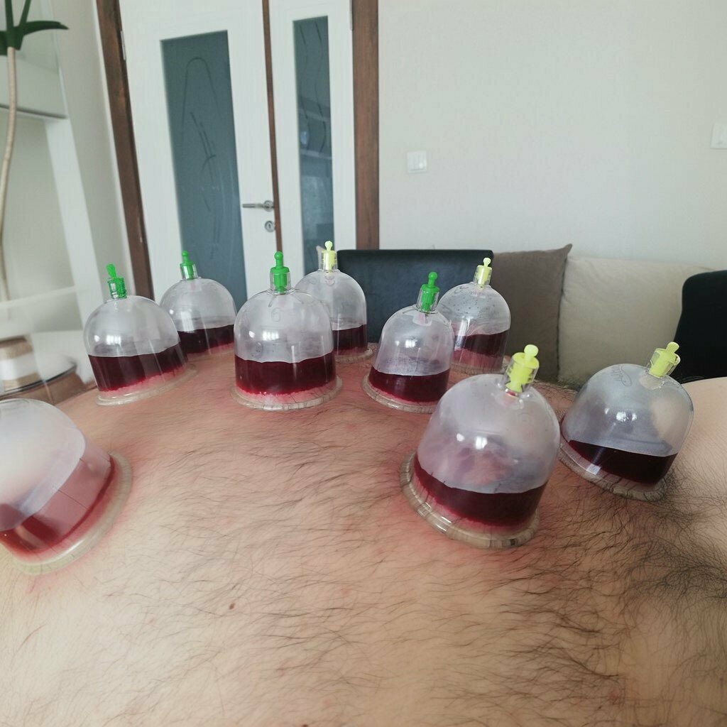 Alternative medicine Malatya Anatolian Cupping Getat Association Malatya Branch, Malatya, photo