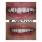 Dentist Dogan Yesilcayir (Mersin, Yenişehir, Nevit Kodalli Avenue, 1), private practice doctors