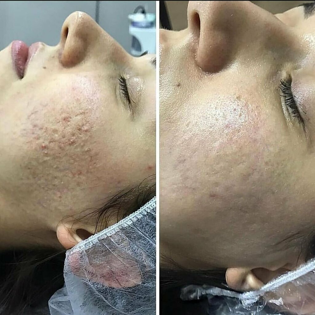 Beauty salon Mabel Epilasyon & Güzellik Hzmt, Antalya, photo