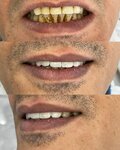 Ozel Es-dent Dis Klinigi (Malatya, Battalgazi, Emeksiz Cad., 11A), dental clinic