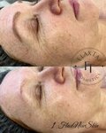 Кабинет эстетической косметологии (ulitsa 30 let Pobedy, 39), cosmetología