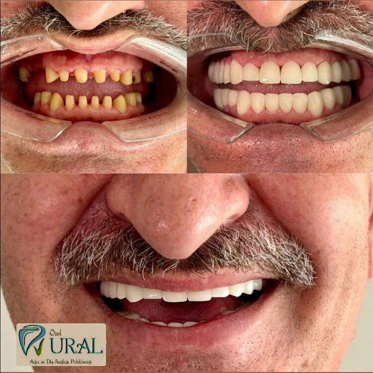 Clínica dental Özel Balkan Dent Ağız ve Diş Sağlığı Polikliniği, , foto