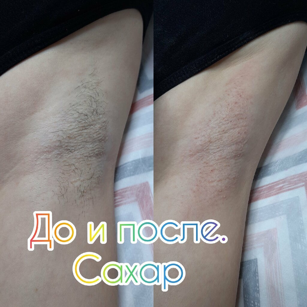 Hair removal U Kiry, Kazan, photo