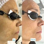 Aesthetic Medicine Clinic Yumed (Marksistskaya Street, 7) ، علم التجميل