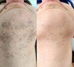 Success Lazer (Fomichovoy Street, 16к5), beauty salon