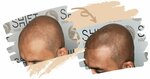 Shift Hair Implant (İstanbul, Yıldız Posta Cad., 6) ، استشارات الاعمال