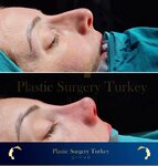 Plastic Surgery Turkey Group (İstanbul, Şişli, Merkez Mah., Bomonti Arkası Sok., 10), médicos privados