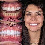 Dr. Senay Bilgin Yilmaz (İstanbul, Besiktas, Konaklar Mah., Akçam Cad., 3E) ، عيادات الأسنان