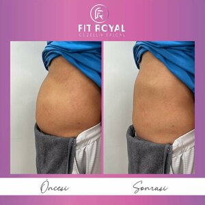 Fit Royal (Aydın, İncirliova, Cumhuriyet Mah., Lozan Cad., 4) ، صالون تجميل