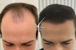 Hair Transplant (Nevskiy Avenue, 22) ، مركز طبي، عيادة