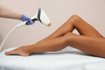 Top lazer pro (ulitsa Palmiro Tolyatti, 3Б), hair removal