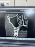 Tulskaya oblastnaya stomatologicheskaya poliklinika, filial № 6 (ulitsa Lenina, 40), clínica dental