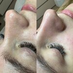 Студия здоровой кожи kat.kosmetolog (Pulkovskoe Highway, 14с6) ، علم التجميل